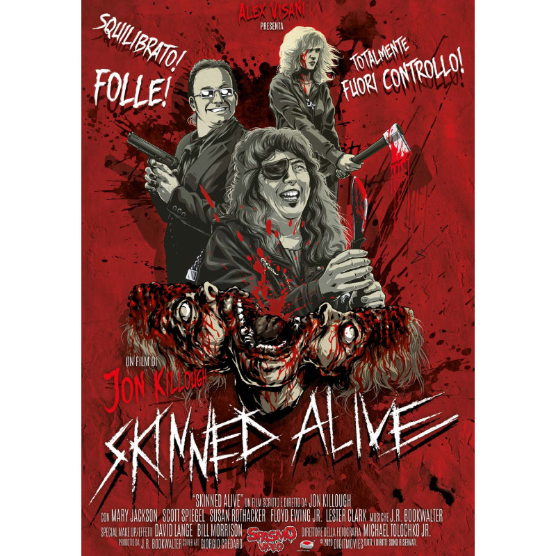 SKINNED ALIVE